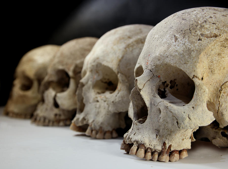 Vier menschliche Schädelknochen