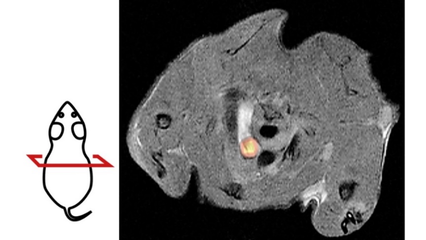 PET/MRT Aufnahme einer Maus mit Gefäßverkalkung. Links daneben eine Zeichnung, die die Schnittebene der PET/MRT Aufnahme zeigt.