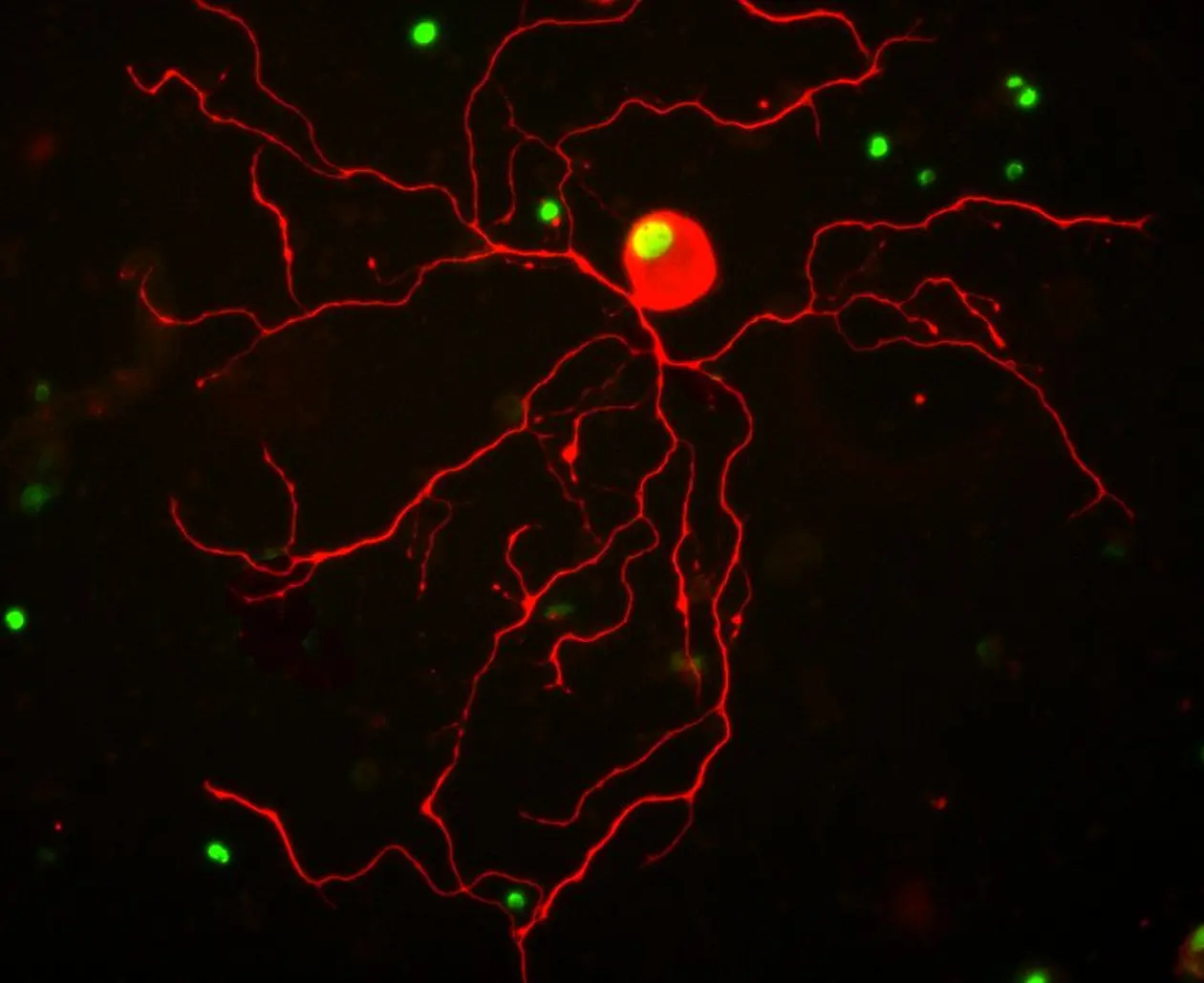 A dorsal root ganglion neuron treated with an activator drug