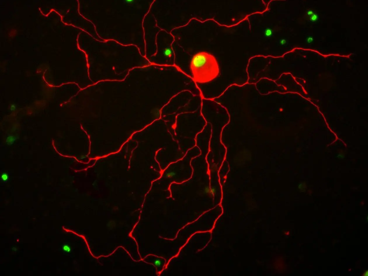 Eine Nervenzelle, die nach Behandlung mit dem Aktivatormolekül lange Zellfortsätze ausbildet
