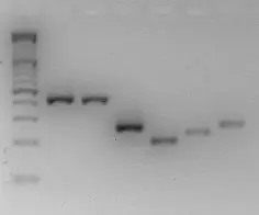 Gel electrophoresis
