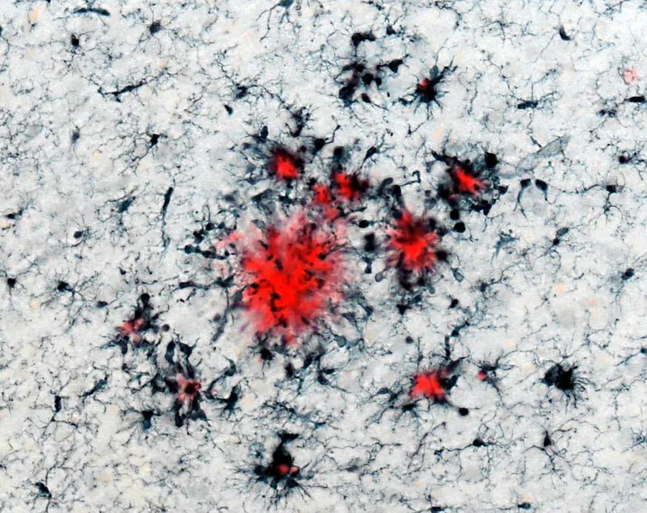 Researchers from Tübingen (Germany) have found that the immune cells of the brain “remember” previous inflammations. They report on this in the journal “Nature”. This image shows such immune cells (in black) clustered around “plaques” (in red), which are insoluble protein deposits characteristic of Alzheimer’s disease. Copyright: DZNE & HIH/Neher