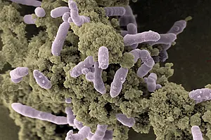 Zellen von rostbildenden eisenoxidierenden Bakterien (Rhodovulum iodosum) assoziiert mit den gebildeten Eisen(III)-Mineralen. Foto: Merle Eickhoff und Nikolas Hagemann