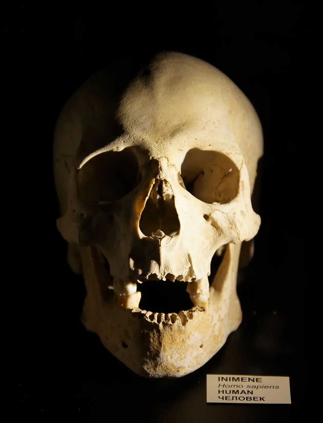 Human skull