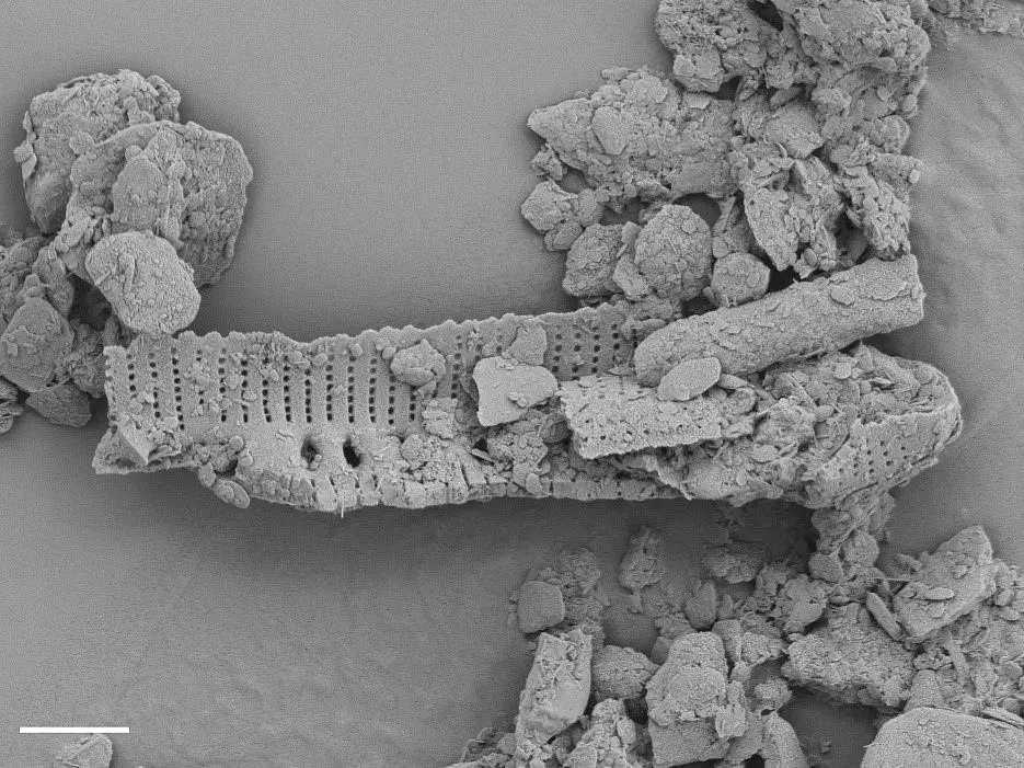 Fragment der Schale einer Kieselalge, gesehen durch ein Rasterelektronenmikroskop