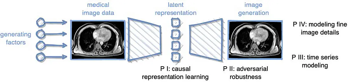 Graphic showing the generation process of medical image data to model disease development and to address robustness of image analysis algorithms: causal representation learning (P1), adversarial robustness (P2), time series modeling (P3) and modeling fine image details (P4)