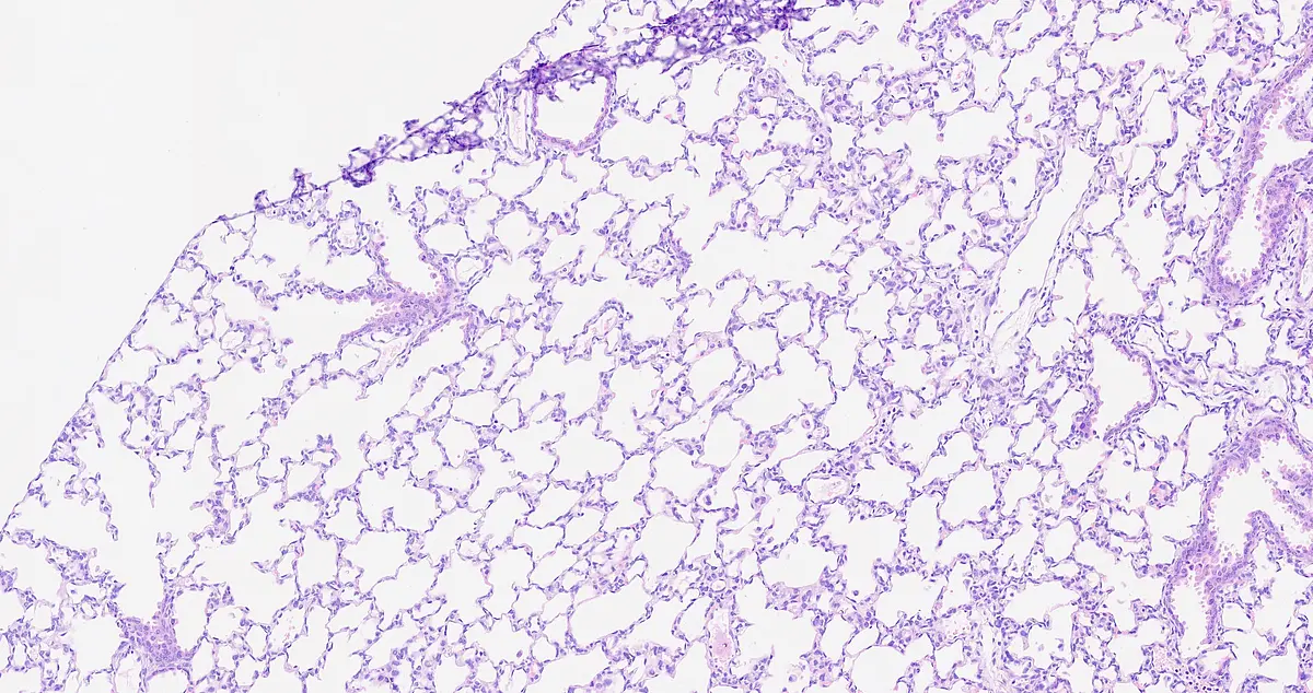 Histologischer Schnitt eines Lungengewebes mit BPD. Dafür wird mit Hilfe eines speziellen Werkzeugs eine sehr dünne Schicht der Lunge abgetrennt.