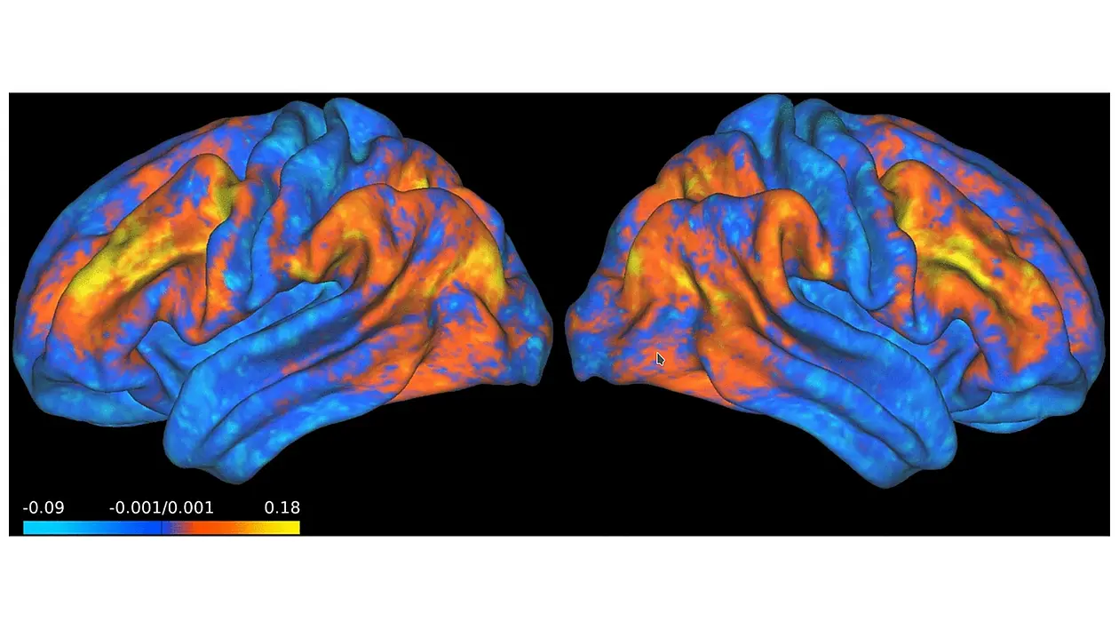 Predicting brain activity (fMRI) Teaser Image