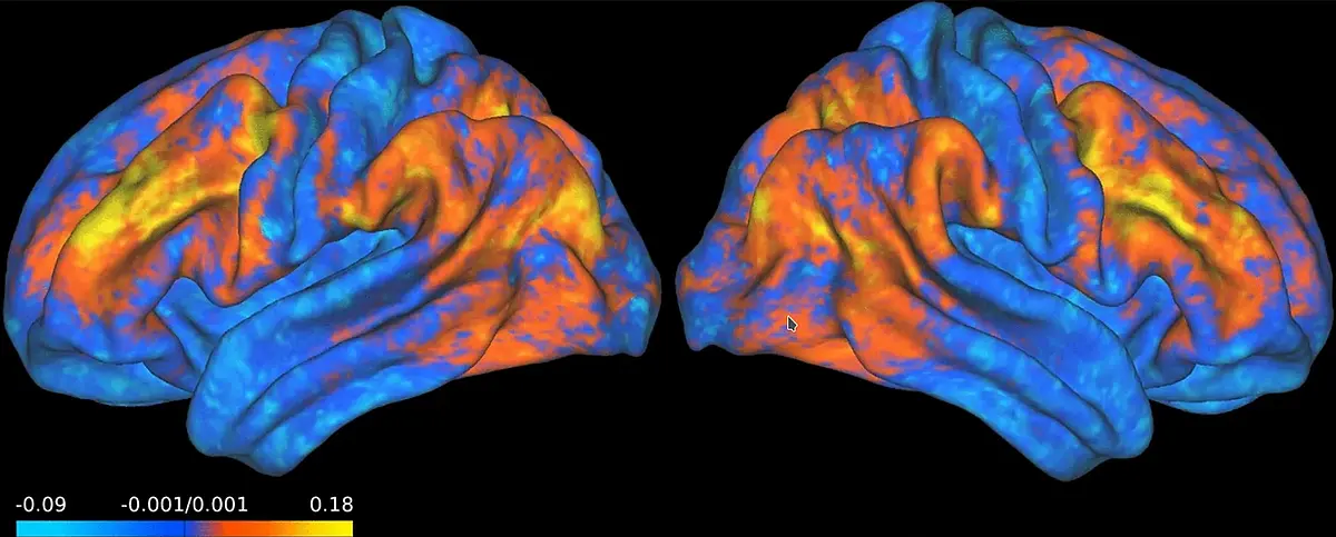 Predicting brain activity (fMRI)