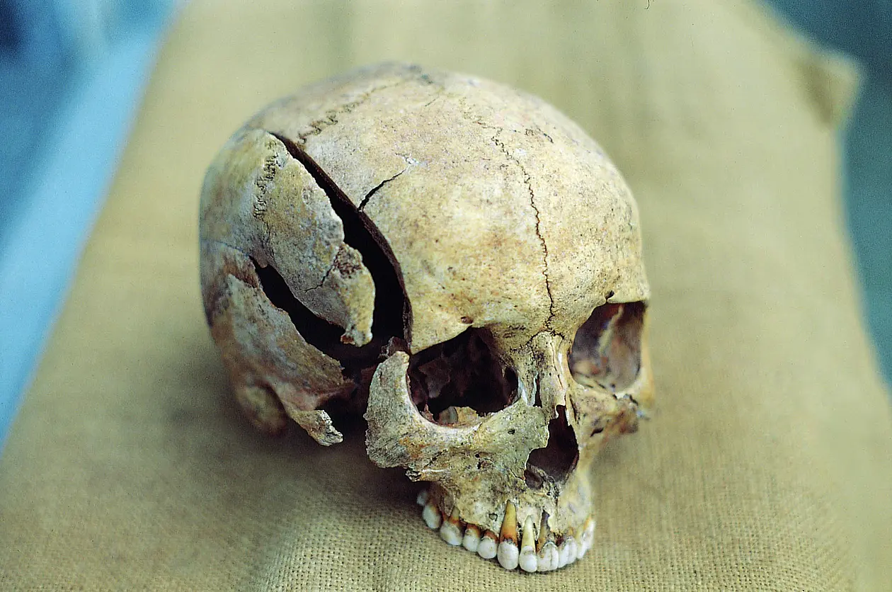 A cranial trauma bears witness of a violent death.