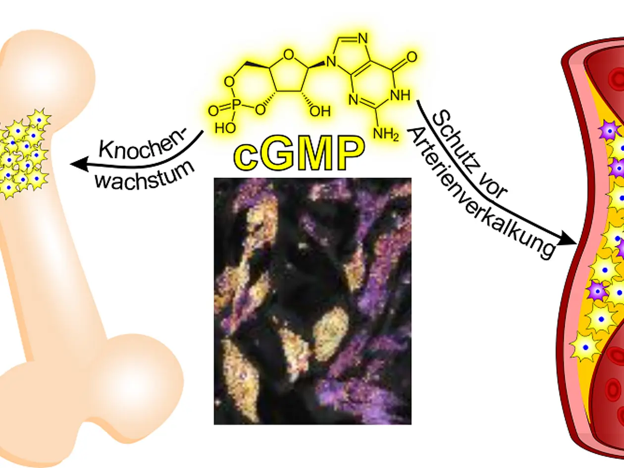 Auswirkungen des cGMP-Signalweges auf Knochenwachstum und Gefäßverkalkung: Wird der cGMP-Signalweg in bestimmten Knochenzellen angeworfen (links, gelbe Zellen) so fördert dies das Knochenwachstum. Ist dieser Signalweg hingegen in Muskelzellen atherosklerotischer Gefäße aktiv (rechts, gelbe Zellen), hemmt dies die Gefäßverkalkung. Interessanterweise ist der hier untersuchte Zweig des cGMP-Signalweges nicht in allen Zellen atherosklerotischer Gefäße aktiv (rechts, lila Zellen). In der Mitte ist oben die chemische Struktur von cGMP gezeigt. Darunter sind Gefäßmuskelzellen zu sehen, die live unter dem Mikroskop beobachtet wurden und gerade viel beziehungsweise wenig cGMP bilden (gelbe bzw. lila Zellen).