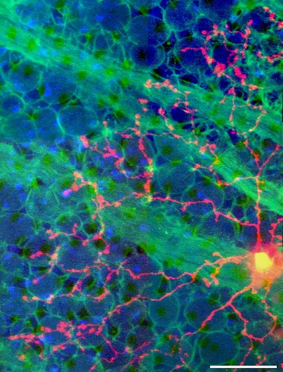 Retina signal processing