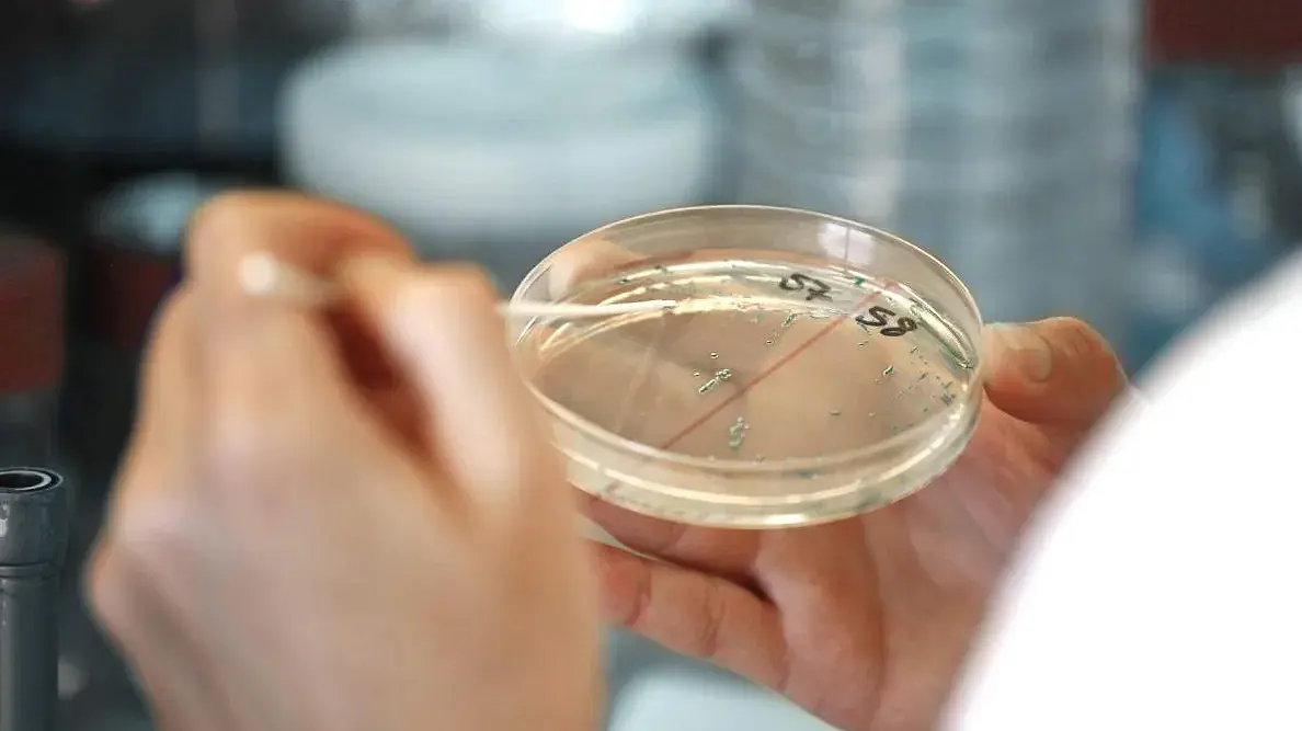 Petri dish