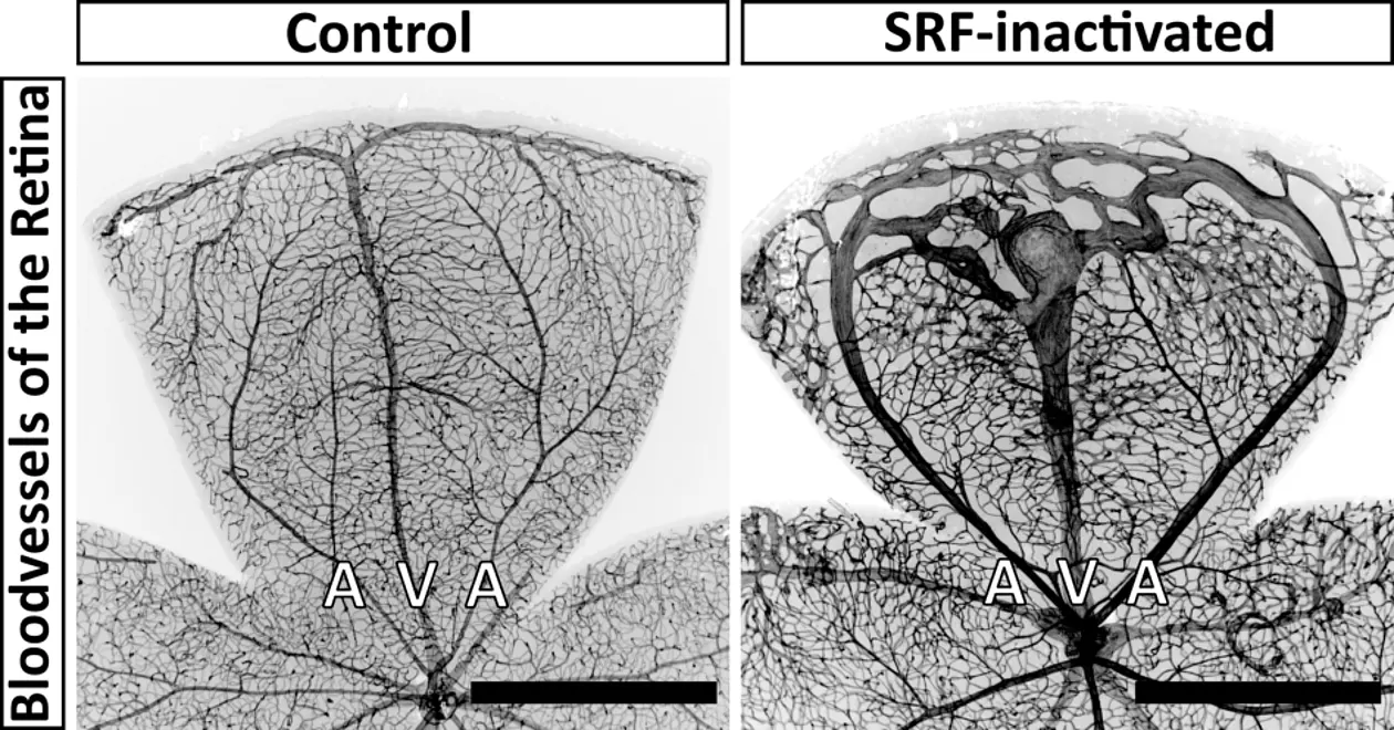 Retinal blood vessels in a control and during targeted deactivation of SRF in smooth muscle cells. In the control, the arteries (A) merge smoothly into tiny microvessels. These in turn lead to the veins (V), which return the blood to the heart. In SRF-inactivated smooth muscle cells, the arteries largely bypass the microvessels and lead directly to the veins. This shortcut results in reduced blood supply to the surrounding tissue. Black bar (bottom right) corresponds to 1 mm. 