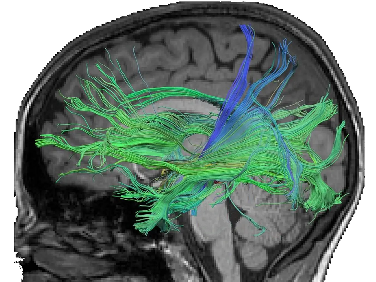 Faserverbindungen im Gehirn, die durch den Hippocampus verlaufen und mit dem Abruf von numerischen Fakten assoziiert sind.