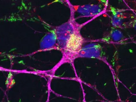 Nervenzellen (lila), die aus Stammzellen von Parkinsonpatienten entwickelt wurden. Die Zellkerne sind blau, die Mitochondrien grün gefärbt. Copyright: Deleidi, 2018