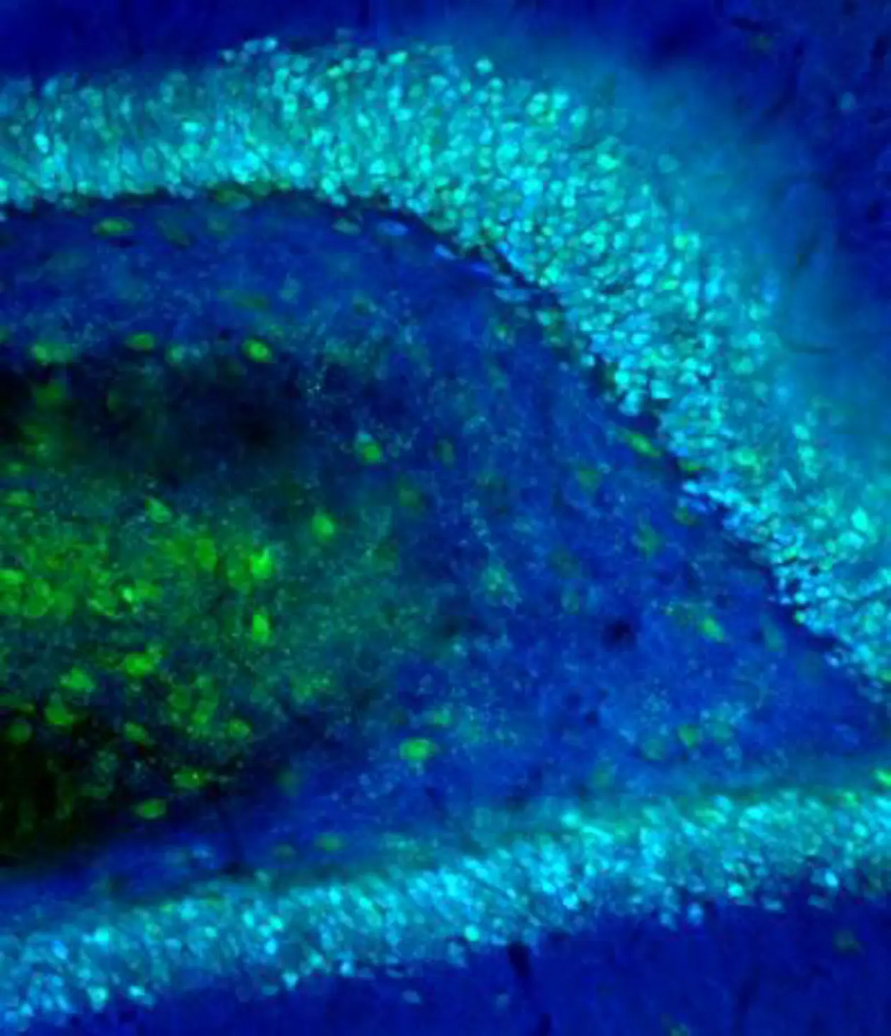 Körnerzellen im Gyrus dentatus einer Ratte, durch Fluoreszenzmikroskopie sichtbar gemacht (in Cyanblau). Abbildung: (c) Burgalossi Lab