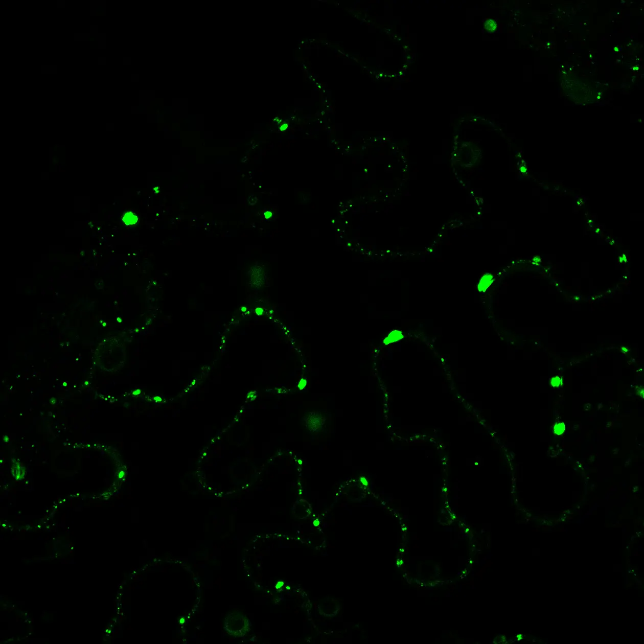 The green specks are components involved in autophagy in the cells of the tobacco plant and degraded by Xanthomonas bacteria, shown under the microscope.