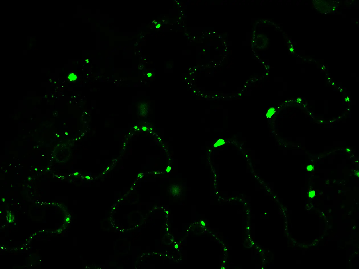 Im mikroskopischen Bild wurden die Komponenten zum Leuchten gebracht, die in den Zellen der Tabakpflanze an der Autophagie beteiligt sind und durch krankheitserregende Xanthomonas-Bakterien abgebaut werden.