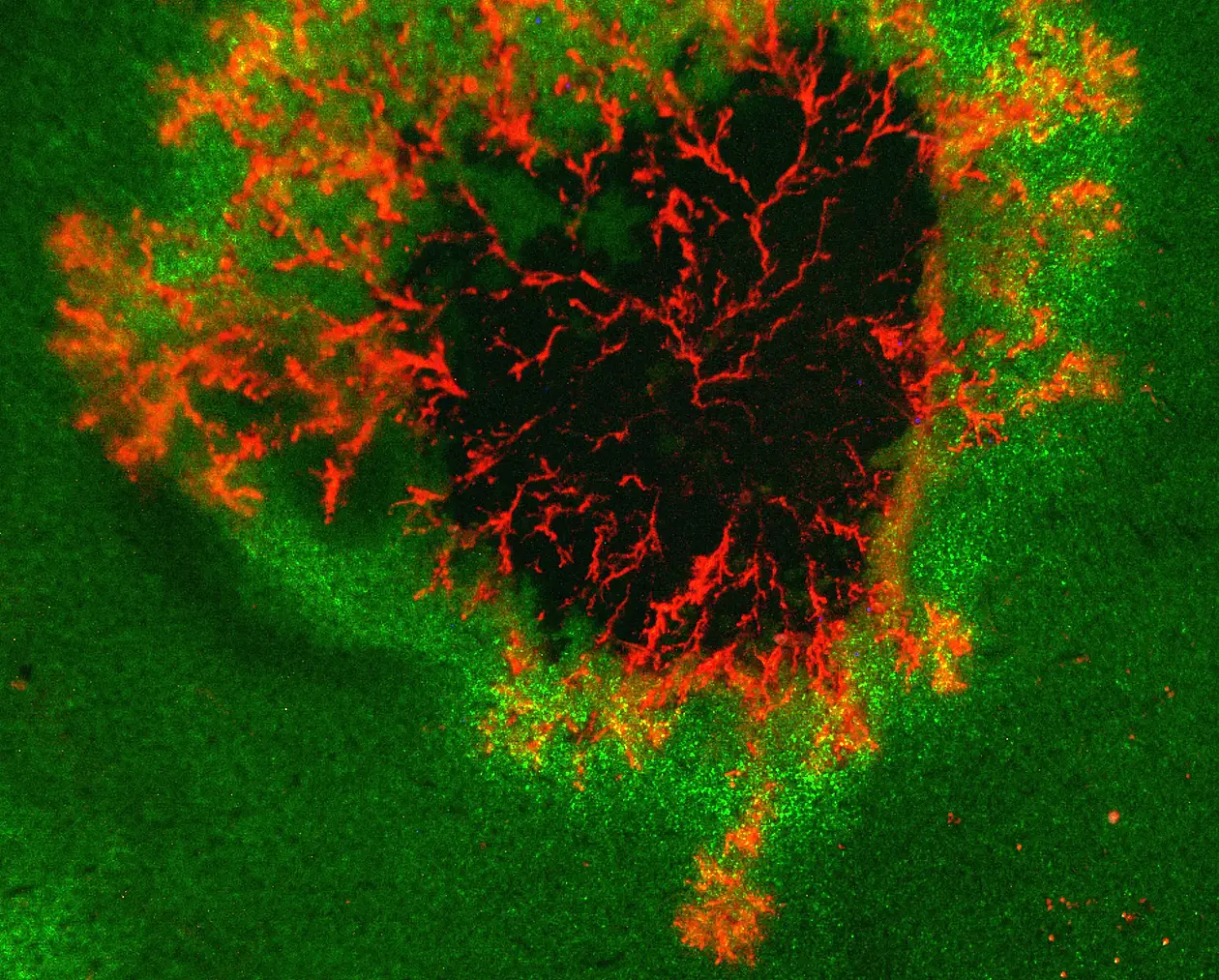 Infektionsstelle des Erregers der Kraut- und Knollenfäule Phytophthora infestans auf einem Blatt. Die sich ausbreitenden Erregerhyphen sind rot-fluoreszierend markiert. Lebendes Blattgewebe ist grün, abgestorbenes Gewebe ist dunkel. Die mikroskopische Analyse der Infektionsstrukturen ermöglicht es uns, die Lebensweise der verschiedenen Erreger zu verstehen. 