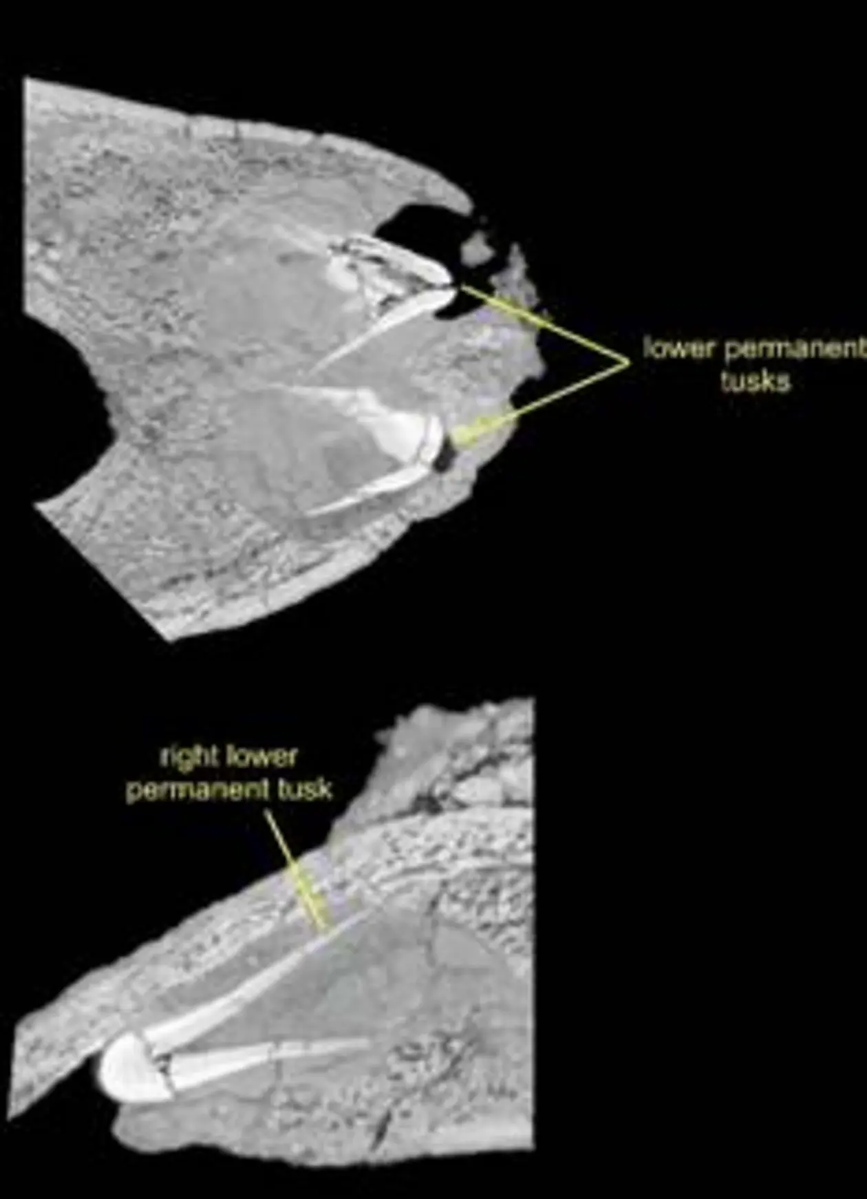 CT-scan slices of the Deinotherium levius mandible showing the erupting lower permanent tusks (transverse slice above, and parasagittal slice below). 