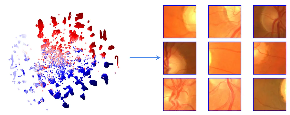 Illustrations showing how medical imaging is used in ophthalmology