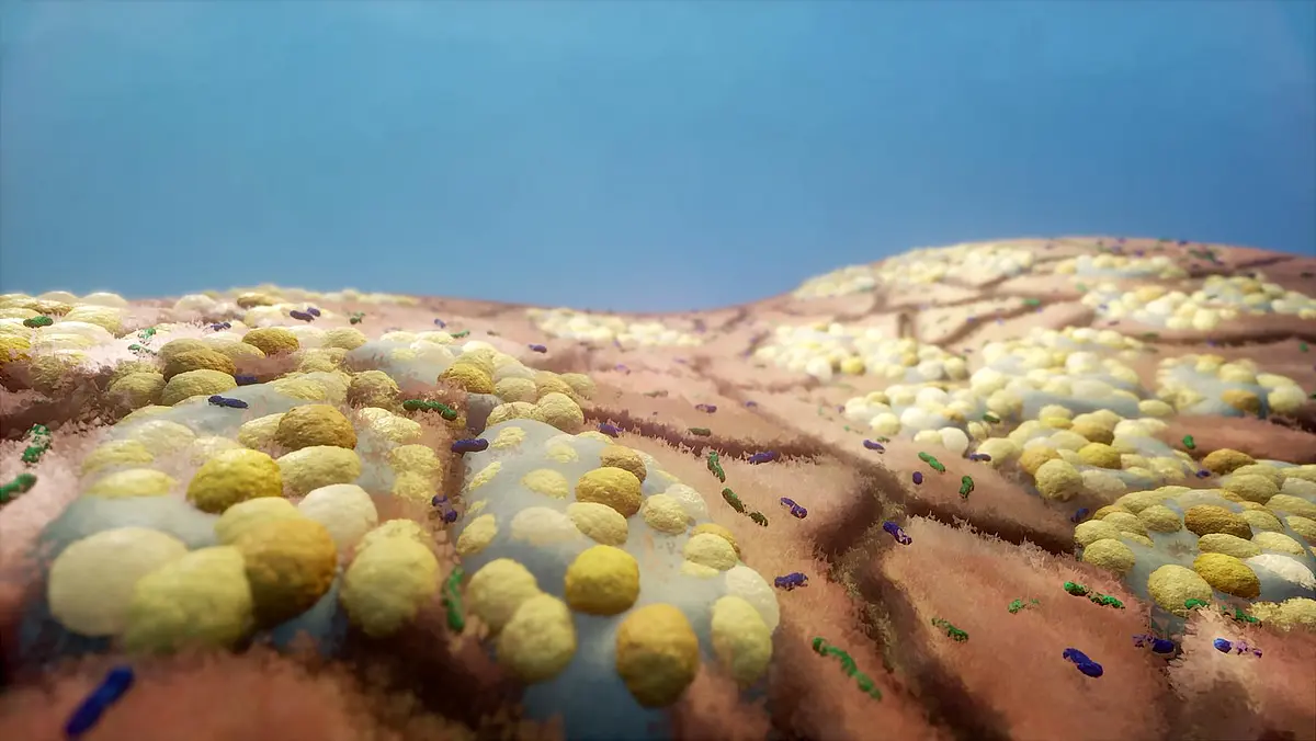 Exemplare representation of a microbial community on the human body: groups of staphylococci in secretion and other skin microbes