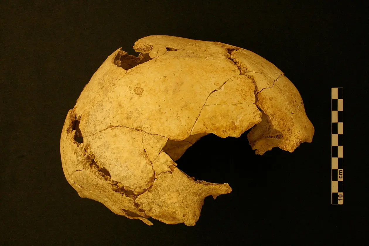 Human skull