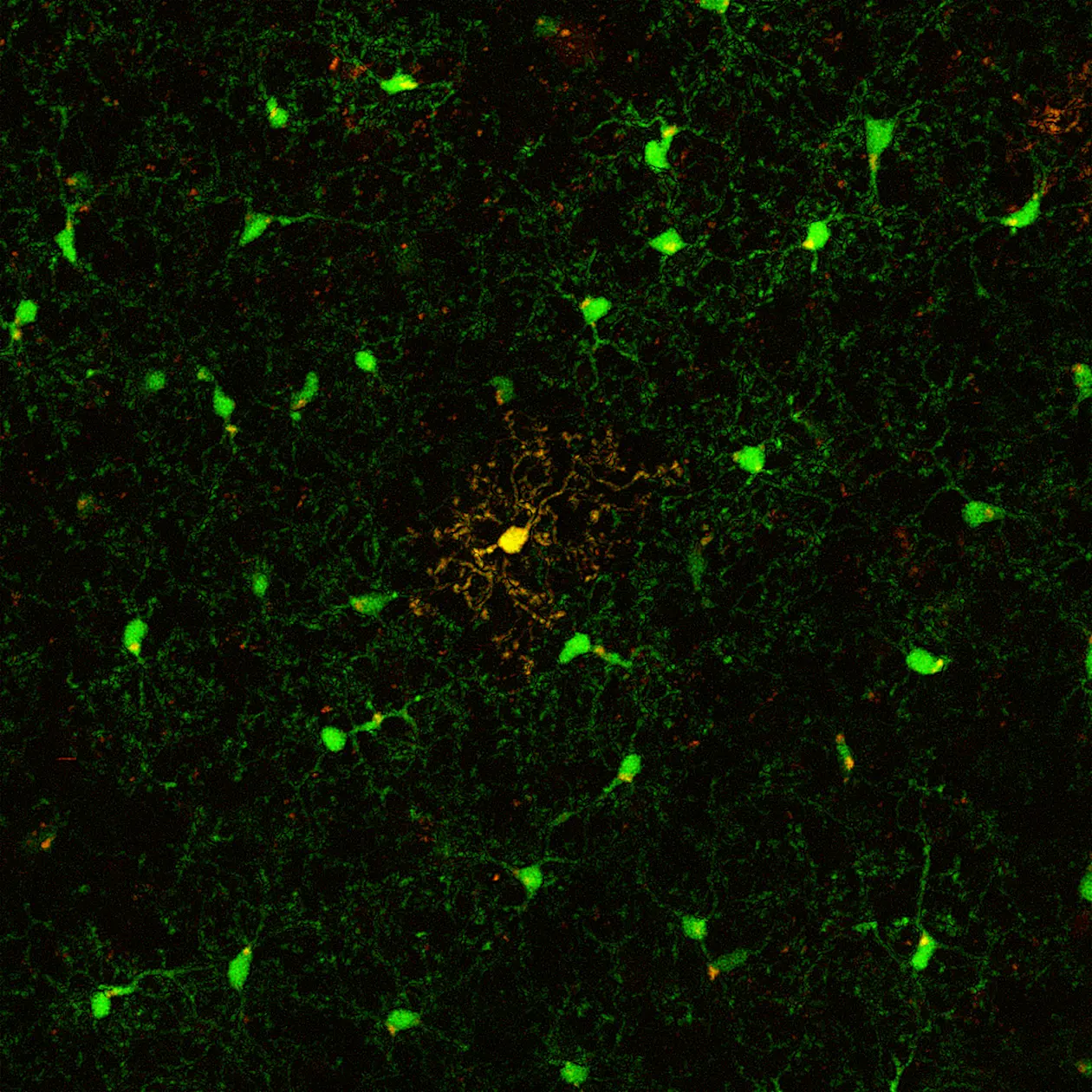 Die Markierung einer einzelnen Mikrogliazelle (in Gelb) erlaubt die Unterscheidung von anderen Mikroglia (in Grün). Auf diese Weise konnten die Forscher die Lebensdauer untersuchen. Copyright: Petra Füger, 2017