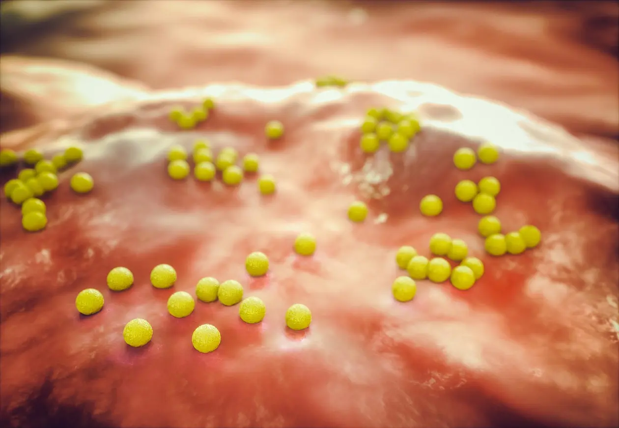 MRSA bacteria (Staphylococcus aureus) make themselve invisible to the immune system with the help of a protein.