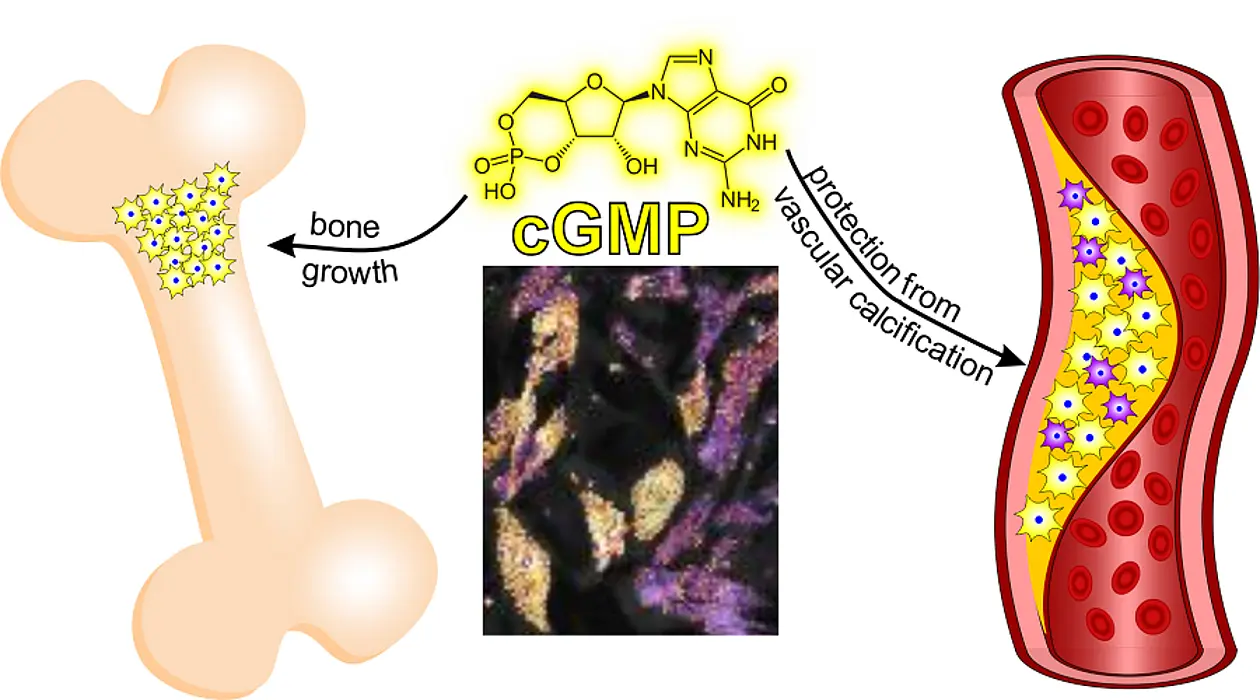 Effects of the cGMP signaling pathway on bone growth and vascular calcification: If the cGMP signaling pathway is activated in certain bone cells (left, yellow cells), this promotes bone growth. If, on the other hand, this signaling pathway is active in muscle cells of atherosclerotic vessels (right, yellow cells), this inhibits vascular calcification. Interestingly, the branch of the cGMP signaling pathway investigated here is not active in all cells of atherosclerotic vessels (right, purple cells). The chemical structure of cGMP is shown at the top center. Below are vascular muscle cells that were observed live under the microscope and are currently producing a lot or a little cGMP (yellow, purple cells). 