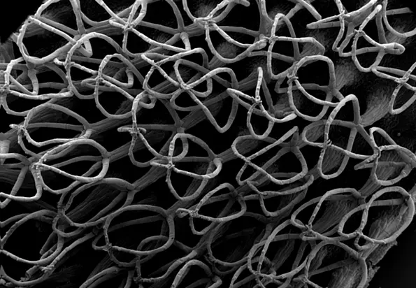 Scanning Electron Microscopic image: The trichomes resemble tiny egg whisks.