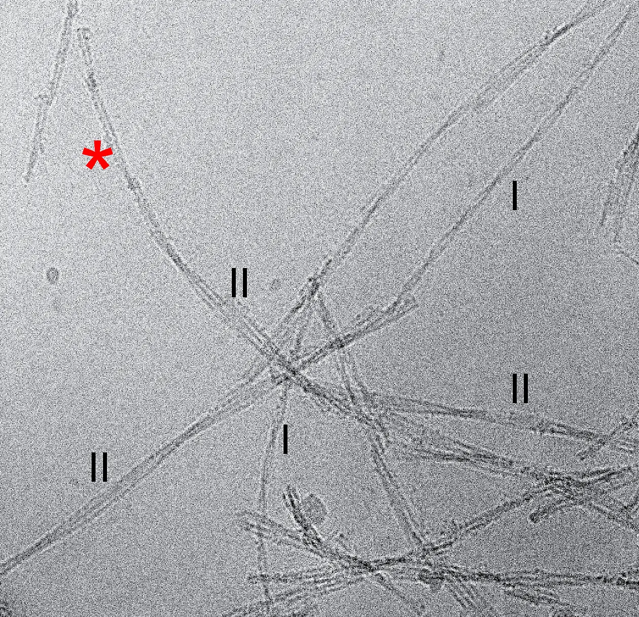 Kryo-elektronenmikroskopische Aufnahme von Aß-Amyloid Fibrillen, welche aus menschlichem Hirngewebe von Alzheimer Patienten aufgereinigt wurden. Hervorgehoben sind einzelne Fibrillen mit unterschiedlichen Formen (Morphologie I und II). Zu sehen ist außerdem eine Fibrille, welche in unterschiedlichen Bereichen verschiedene Morphologien aufweist (roter Asterisk). 