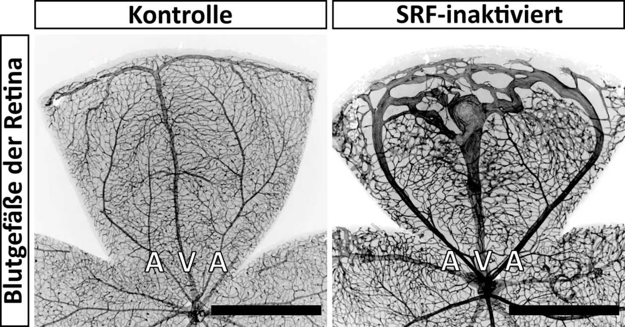 Retinale Blutgefäße in einer Kontrolle und bei einer gezielten Inaktivierung des Serum-Response-Faktors (SRF) in glatten Muskelzellen. In der Kontrolle gehen die Arterien (A) fließend in kleinste Mikrogefäße über. Diese führen wiederum zu den Venen (V), welche das Blut zum Herzen zurückführen. Bei einer SRF-Inaktivierung in glatten Muskelzellen umgehen die Arterien weitestgehend die Mikrogefäße und führen direkt zu den Venen. Durch diese Abkürzung wird das umliegende Gewebe weniger mit Blut versorgt. Der schwarze Balken (rechts unten) entspricht 1 Millimeter. 