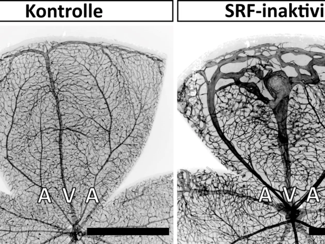 Retinale Blutgefäße in einer Kontrolle und bei einer gezielten Inaktivierung des Serum-Response-Faktors (SRF) in glatten Muskelzellen. In der Kontrolle gehen die Arterien (A) fließend in kleinste Mikrogefäße über. Diese führen wiederum zu den Venen (V), welche das Blut zum Herzen zurückführen. Bei einer SRF-Inaktivierung in glatten Muskelzellen umgehen die Arterien weitestgehend die Mikrogefäße und führen direkt zu den Venen. Durch diese Abkürzung wird das umliegende Gewebe weniger mit Blut versorgt. Der schwarze Balken (rechts unten) entspricht 1 Millimeter. 