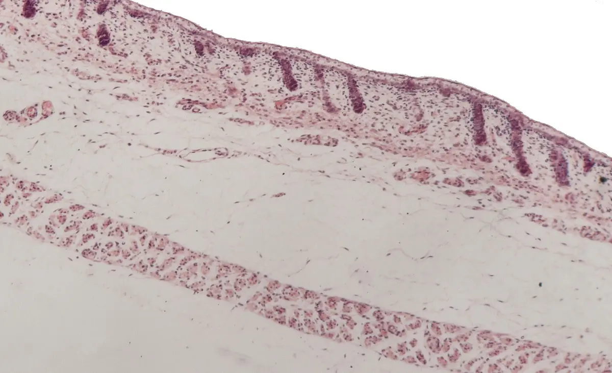 Haarentwicklung bei einem Schaf-Embryo: Die äußere Hautschicht faltet sich ein (dunkle Partien). 