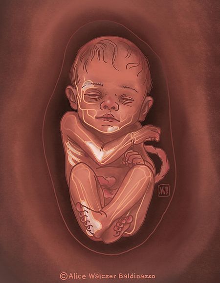 Artist's reconstruction of the Neanderthal foetus 