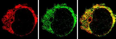 Fluoreszenzmikroskopische Aufnahme einer T Zelle. Foto: AG Hailfinger