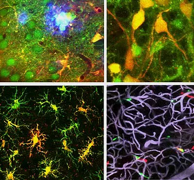 The different scientific topics of the Garaschuk lab