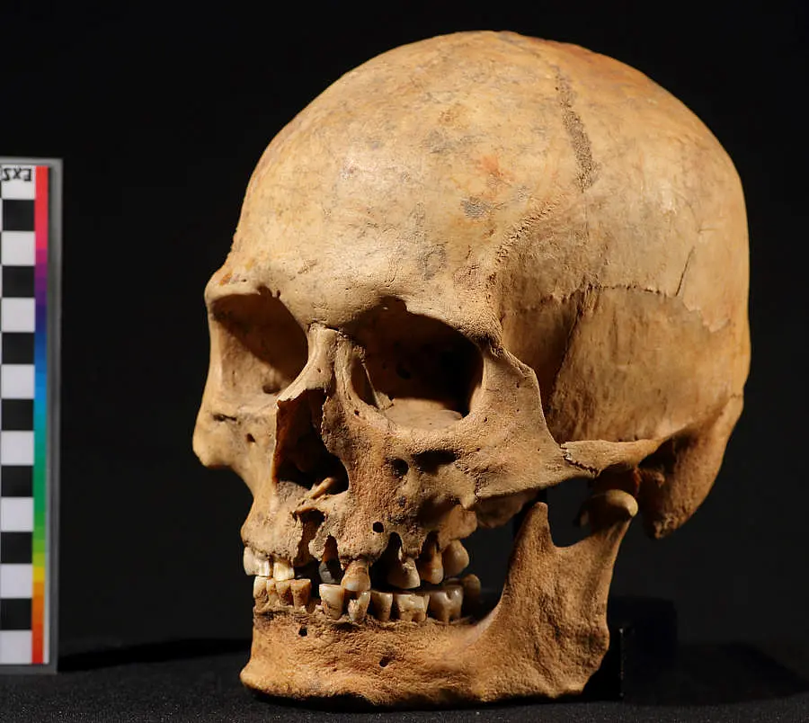 Skull of the Nizhnetytkesken individual. 