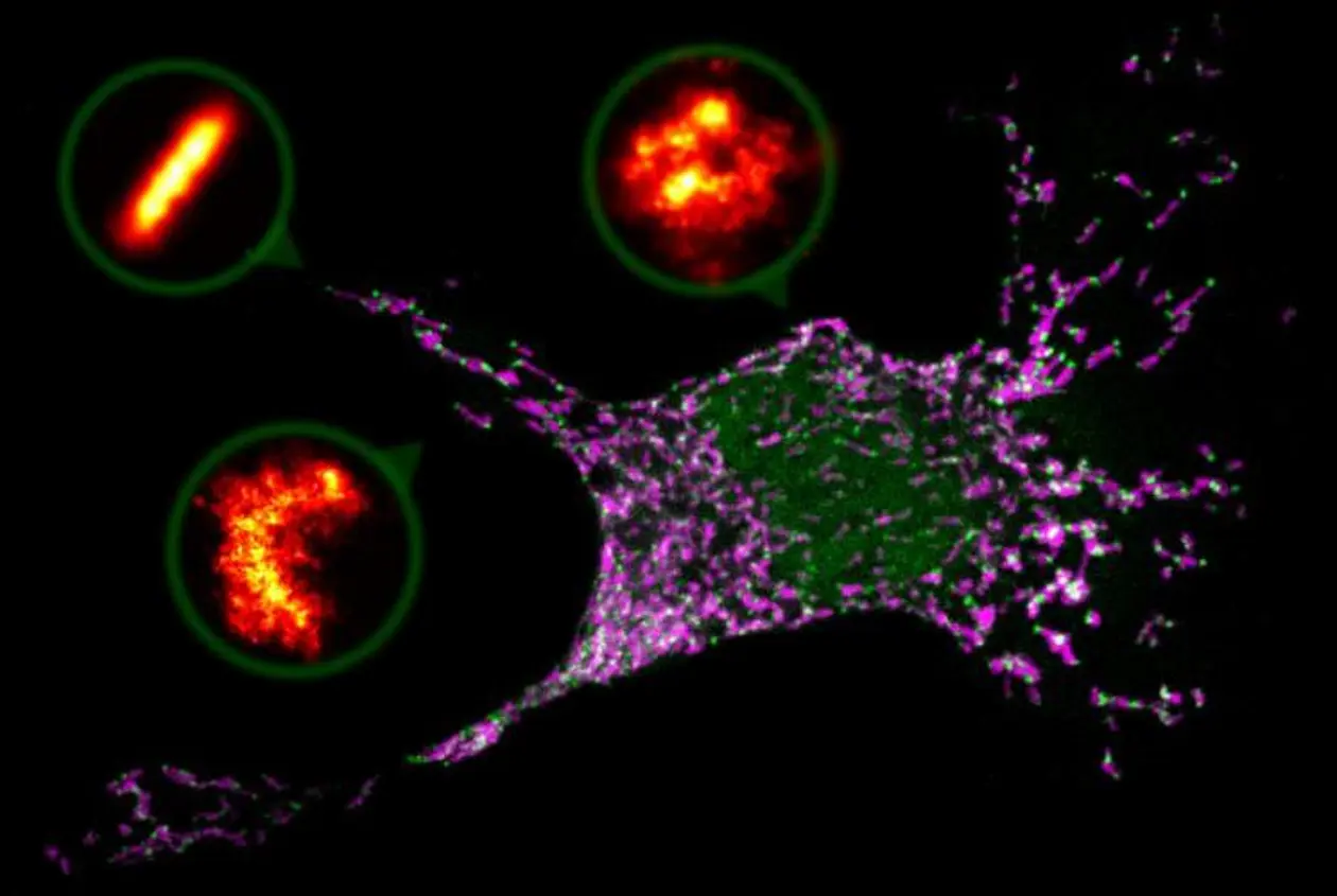 Die mit dem Konfokalmikroskop aufgenommene Säugetierzelle befindet sich im Prozess der Apoptose. Die Mitochondrien sind in Magenta eingefärbt, die Bax-Proteine in Grün. Die Vergrößerungen zeigen hochaufgelöste mikroskopische Bilder der Bax-Zusammenlagerungen aus Säugetierzellen als Linie, Bogen und Ring. Abbildungen: Raquel Salvador Gallego/Universität Tübingen