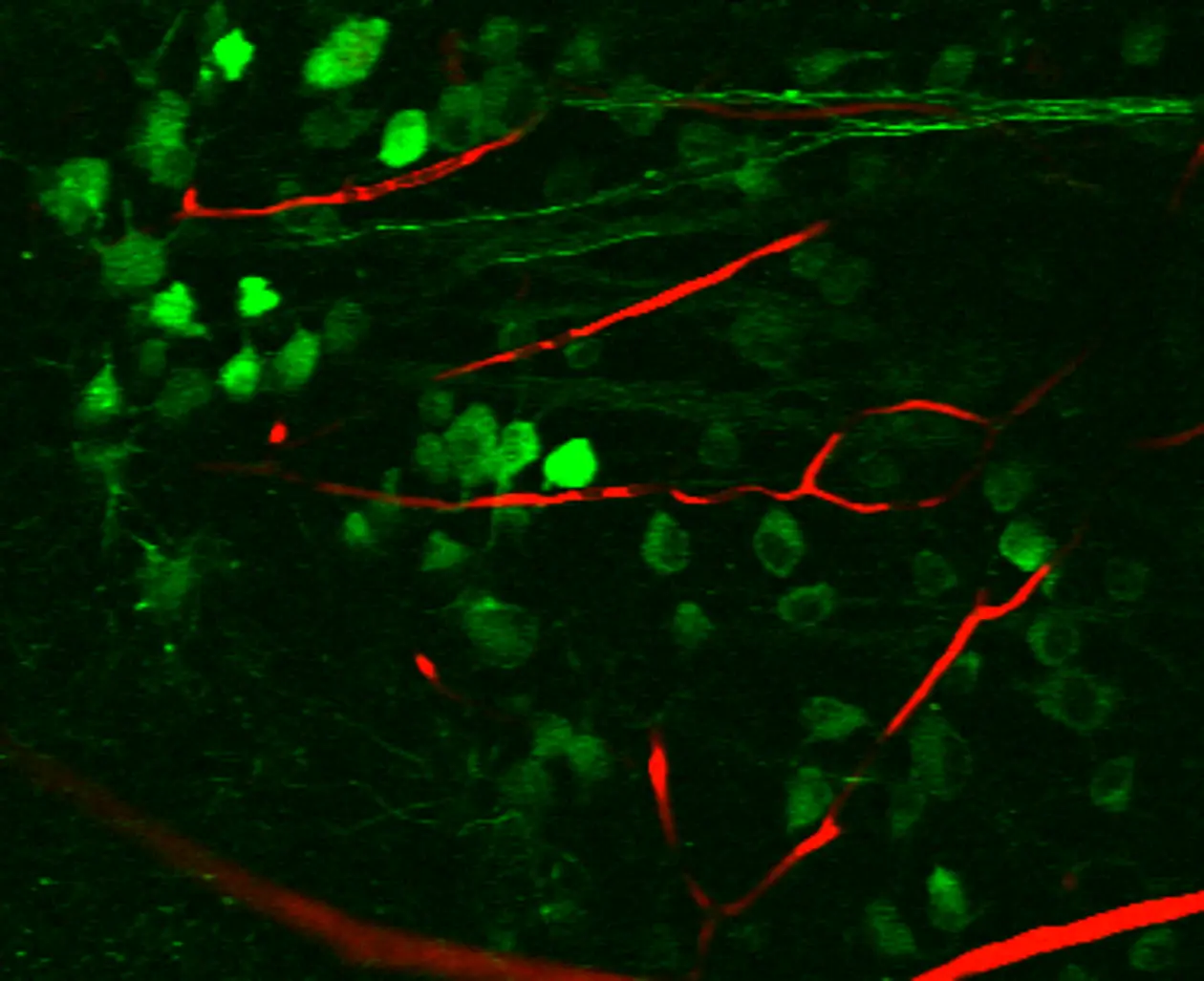 Two-photon microscope image of retinal ganglion cells (RGCs, green). Axons of these cells (top right, green) move across the optical nerve into the visual thalamus. Blood vessels are shown in red.