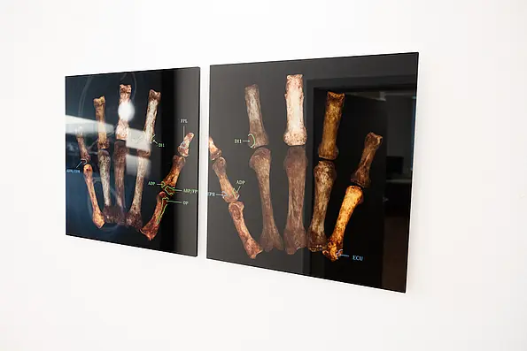 Illustration of hand bone 3D models