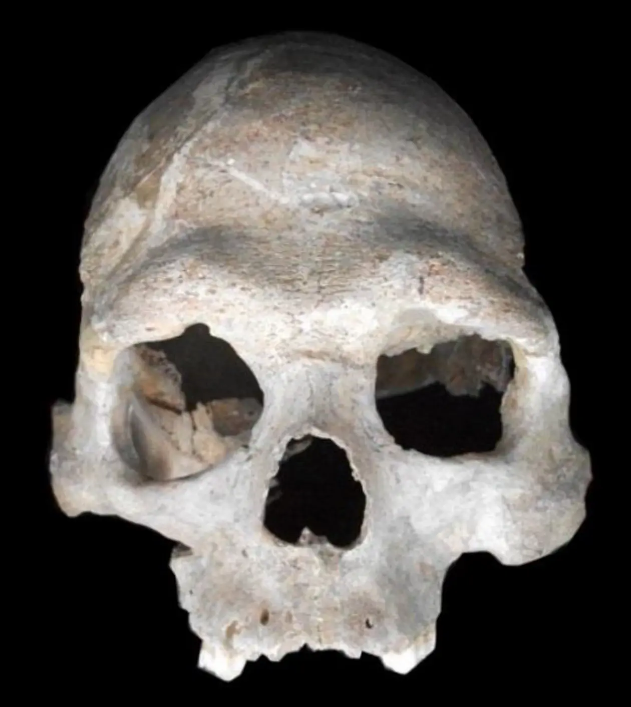 (A) Schädel des ungefähr 8.000 Jahre alten männlichen Jägers und Sammlers von der Loschbour-Fundstelle in Luxemburg, dessen Genom sequenziert wurde. Bild: Dominique Delsate, Musée national d'Histoire naturelle de Luxembourg