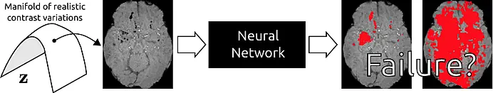 Illustration showing how the medical prediction algorithm works