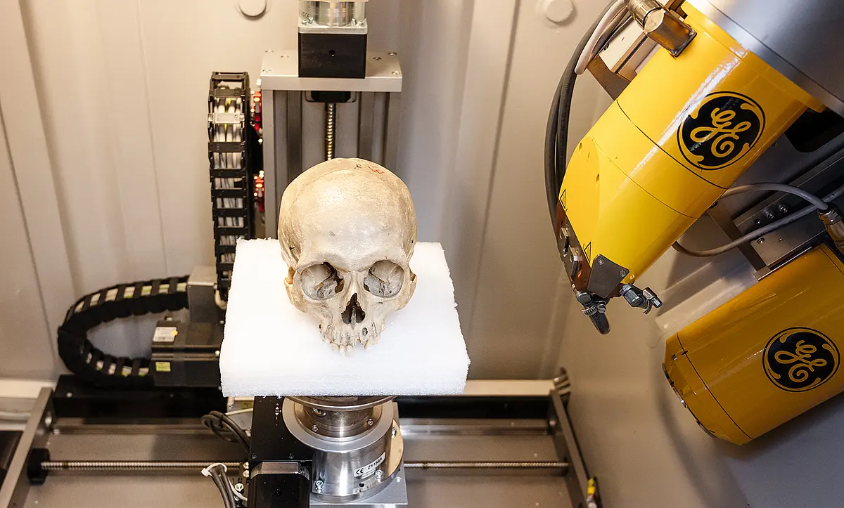 Schädel im CT-Scanner.