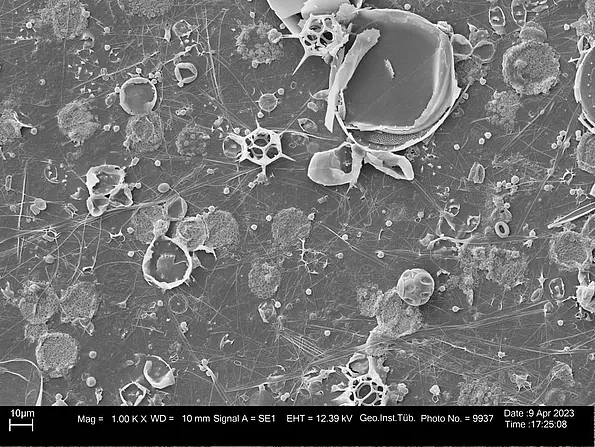 Grey-coloured plankton sample 