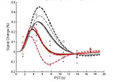 Peri-stimulus Time course of BOLD response