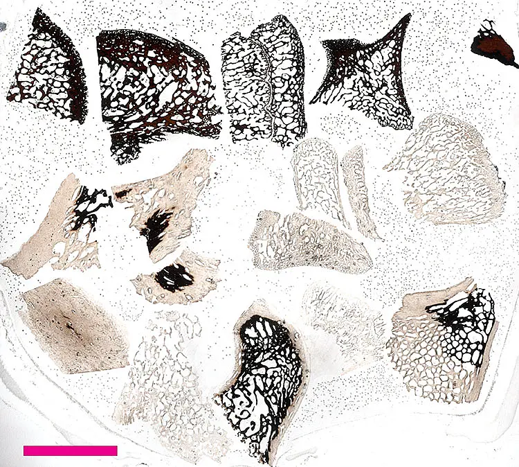 bone ref ts scan
