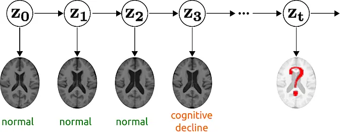 Illustration of Medical Imaging, showing cognitive decline